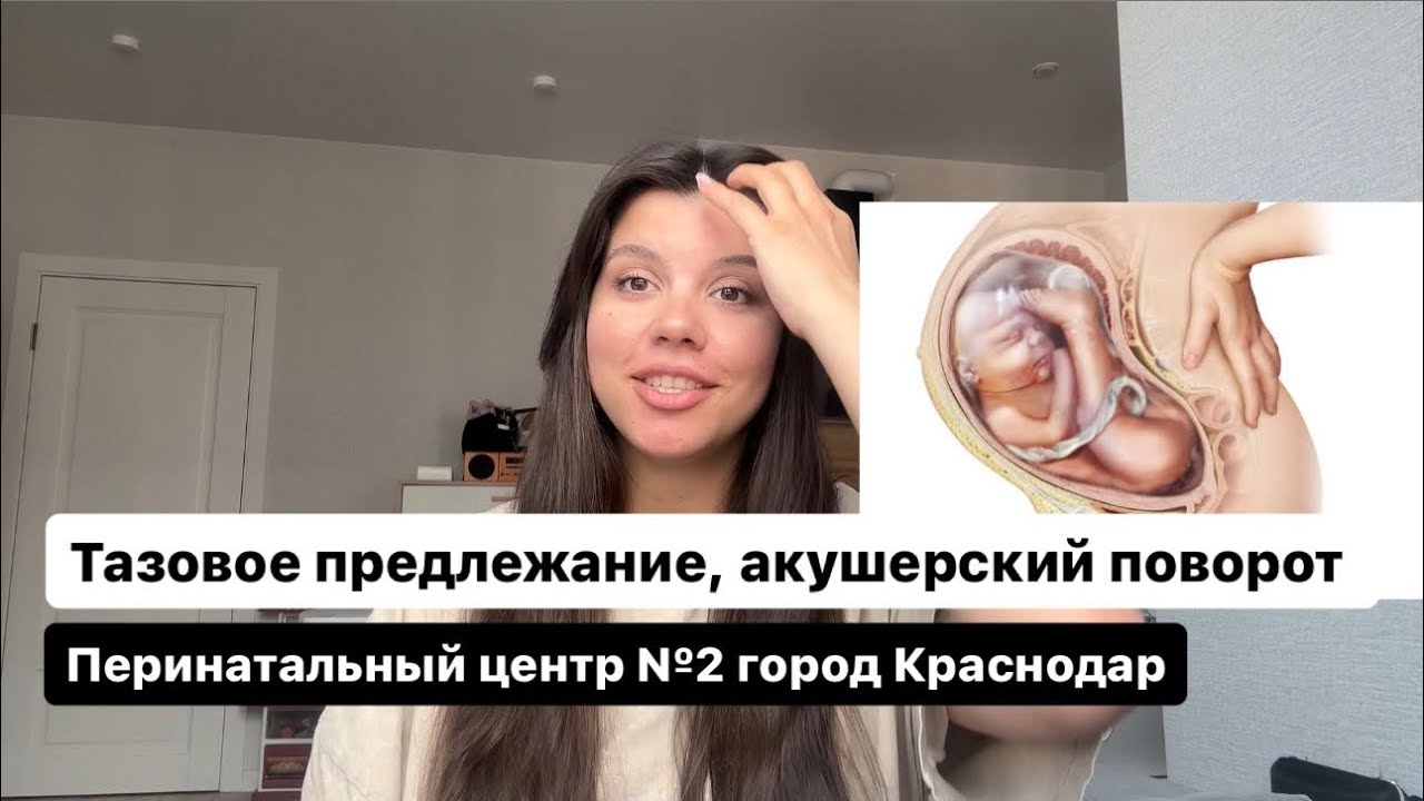 Акушерский поворот при тазовом предлежании плода