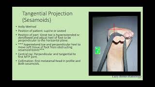 Positioning of the Toes Episode 13 #LazyBonesRadiology