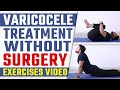 Varicocele treatment without surgery  varicocele exercises  varicocele natural treatment