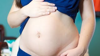 البطن بعد الولاده -العضله النائمه -تثبيت الوزن د. عبير ضيف