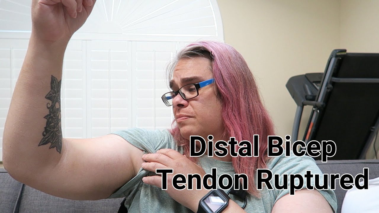 My Distal Bicep Tendon Rupture and Repair Day Before Surgery YouTube