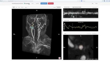 Vessel Assessment Web Tool - Demo