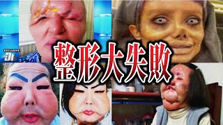 【ゆっくり解説】これは酷すぎる...整形で大失敗してしまった人たち
