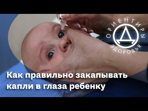 Как правильно закапывать капли в глаза ребенку.