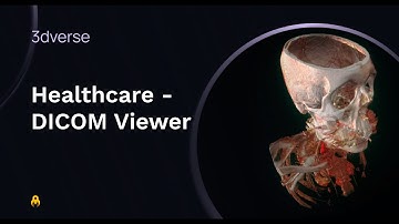 3dverse for Healthcare 🏥 -  DICOM viewer template