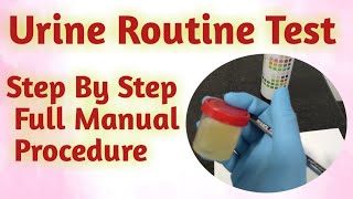 urine routine test | How to Process urine routine