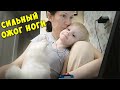 Ожог ноги у Леши / Аллергены / Новогодняя суета / GrishAnya Life