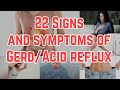 22 SIGNS AND SYMPTOMS OF GERD/ACID REFLUX