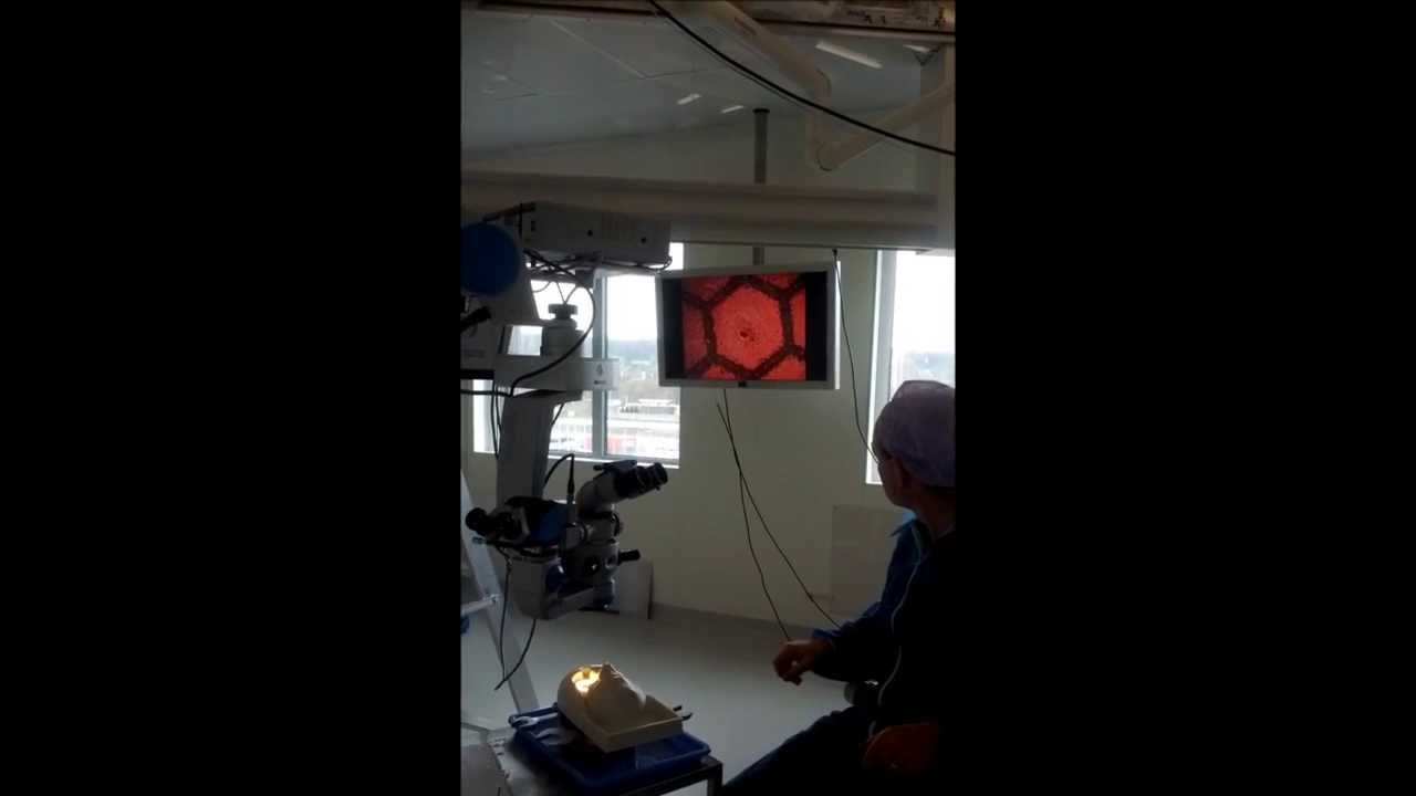 Vibration isolation of surgical microscopes. Robustness demonstration