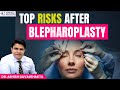 Top Risks After Blepharoplasty 👁️ |  Bruising, Swelling, Dry Eyes  |  Dr Ashish Davalbhakta