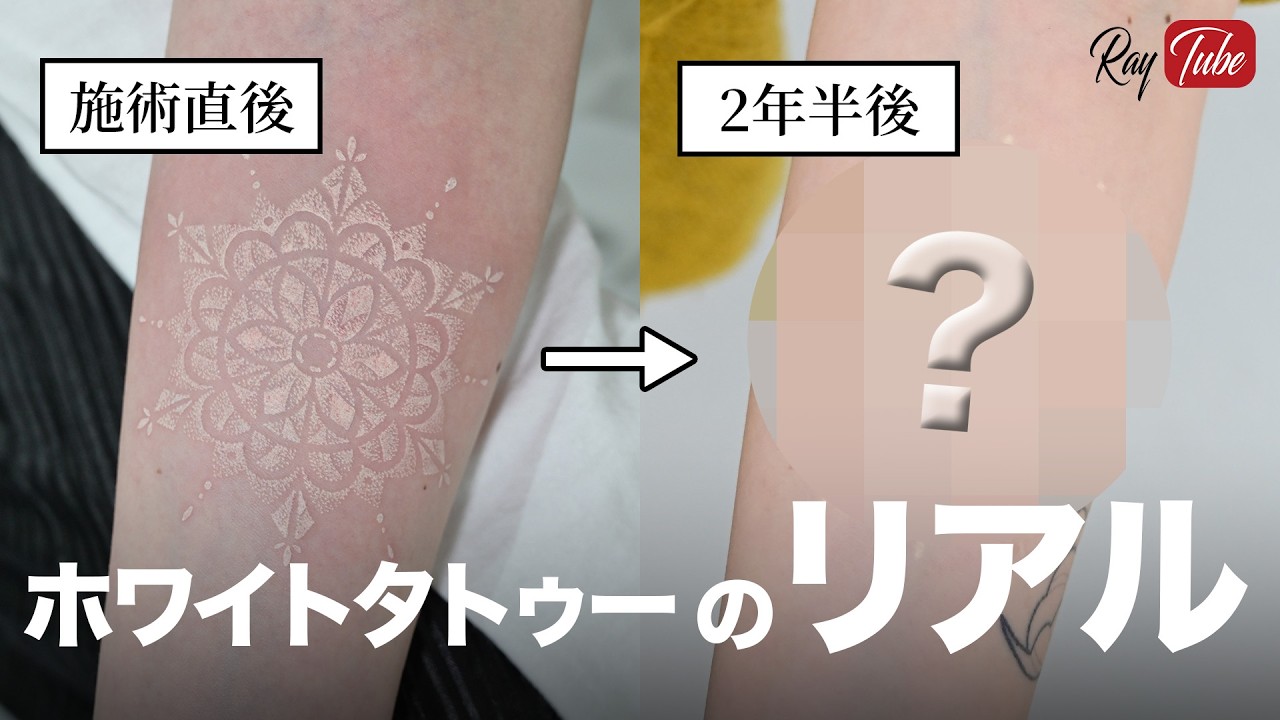 White Tattoos] Do they really yellow? Are they prone to color 