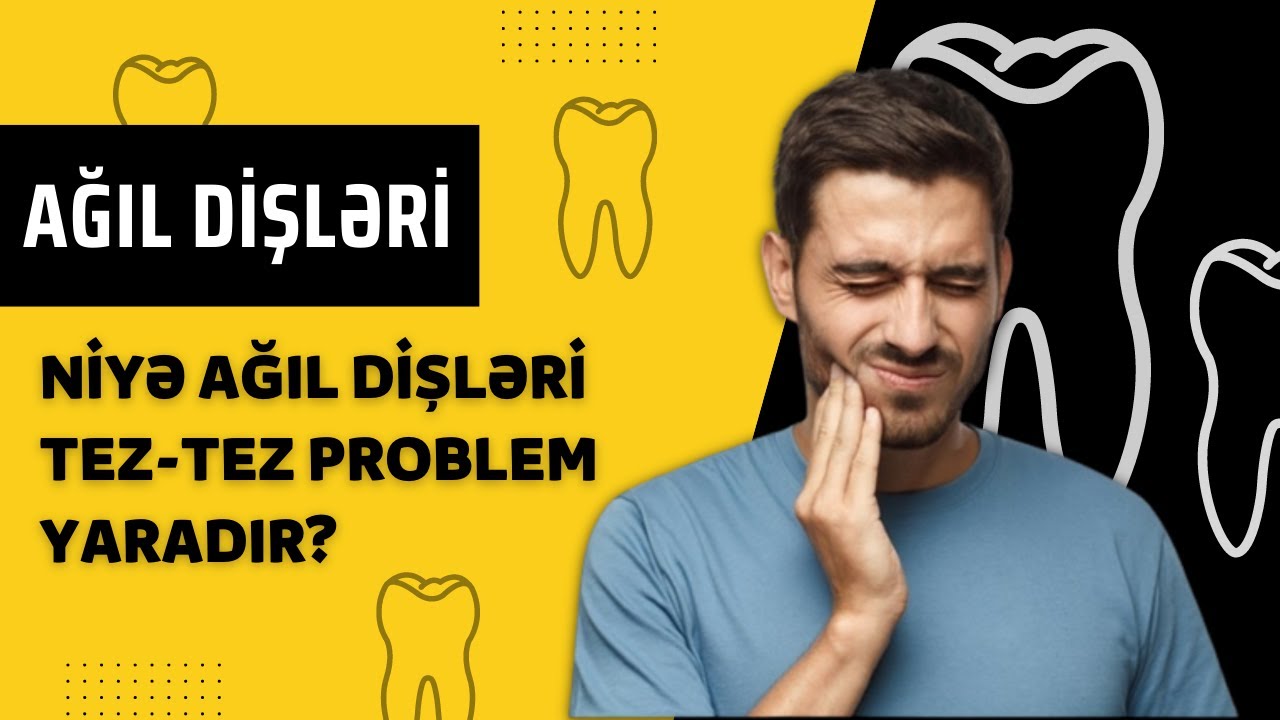 Ağıl dişləri barədə bilməli olduğumuz gerçəklər | Diş Məsələsi #2 #dismeselesi