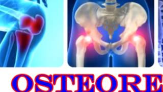 Osteoren crema(Osteoren unguento per il trattamento di dolori articolari., 2017-01-31T12:50:18.000Z)