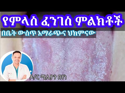 ቪዲዮ: ከሚከተሉት ውስጥ የትኛው አልጌ ዚጎቲክ ሚዮሲስ ይከሰታል?