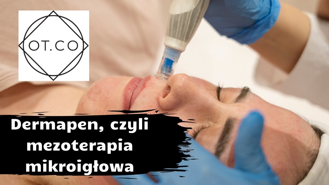 Mezoterapia mikroigłowa Dermapen - działanie zabiegu i pielęgnacja po nim
