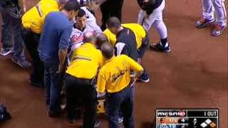 Manny Machado carted off the field on a stretcher after gruesome Leg Injury