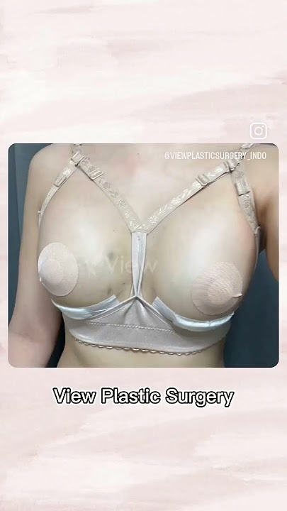 Apakah Anda ingin payudara alami dan indah?🙄 #operasipayudara