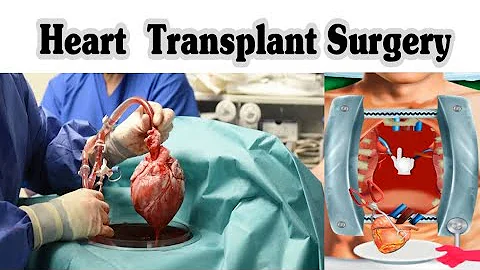 Heart Transplant Surgery -3D Animation - DayDayNews