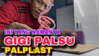 Yang mau pasang gigi palsu valplast simak step by step cara bikinnya sampai jadi