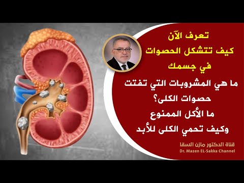 أفضل علاج ل تفتيت حصى الكلى من اليوم قل وداعا لحصى الكلى أمر هام في تفتيت وتنظيف الكليتان من الحصى