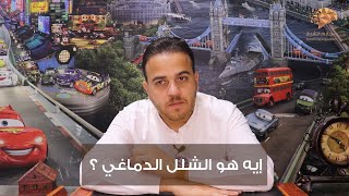 س16 إيه هو الشلل الدماغي ؟ سلسلة 100 س وج في مخ وأعصاب الأطفال | د. حازم الشيخ