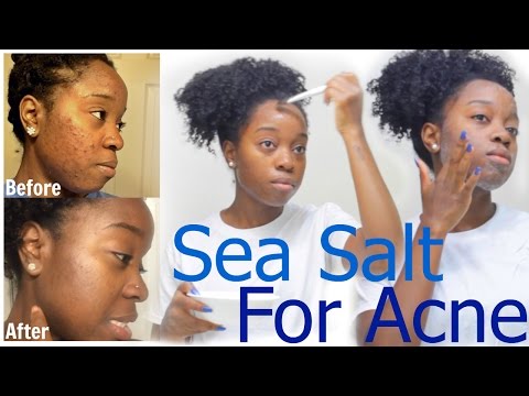 Video: Dark Spots On Europe Called Sea Salt