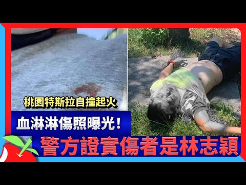 桃園特斯拉自撞起火　血淋淋傷照曝光！警方證實傷者是林志穎 | 台灣新聞 Taiwan 蘋果新聞網