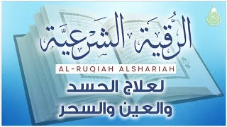 أقوى رقية شرعية شاملة مكتوبة لعلاج السحر والمس والحسد والعين الحاقدة في الرزق والبيت والأولاد