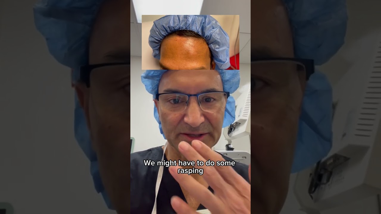 HUGE OSTEOMA REMOVAL - DR. TANVEER JANJUA - NEW JERSEY