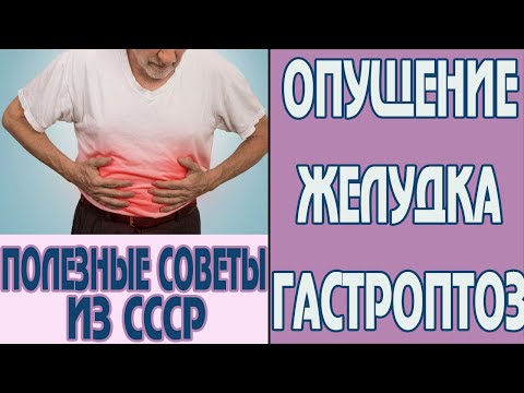 Видео: Гастроптоза - изпразване на стомаха, симптоми и лечение