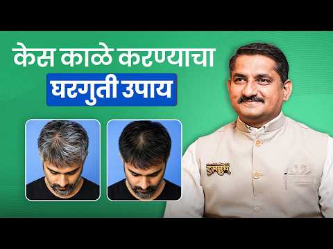 केस अकाली पांढरे का होतात? आयुर्वेदिक उपचार & घरगुती उपाय | Premature Grey Hair | Dr.Harish Patankar