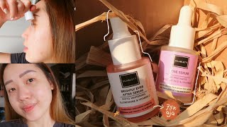 REVIEW SCARLETT WHITENING BRIGHTLY EVER AFTER & ACNE SERUM! CUMA 75RB GUYS, BAGUS GAK YA?