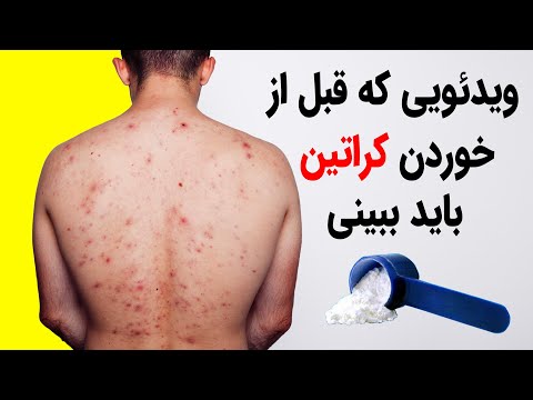 تصویری: آیا ssn آزمون ورودی دارد؟