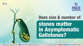 Does size & no of stones matter in Asymptomatic Gallstones? | PACE Hospitals #Shortvideo #gallstones