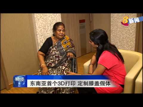 本地首次引进膝盖三维打印技术为病人量身定