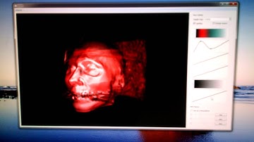 Real-time volume rendering combining MPR and ray casting