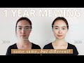 1 Year Mewing Before & After (Age 29)