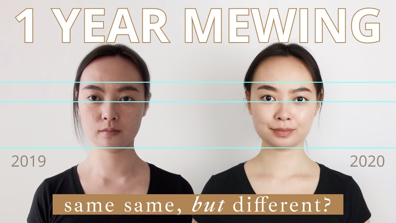 3 years and 9 months, 18-21 years old : r/Mewing