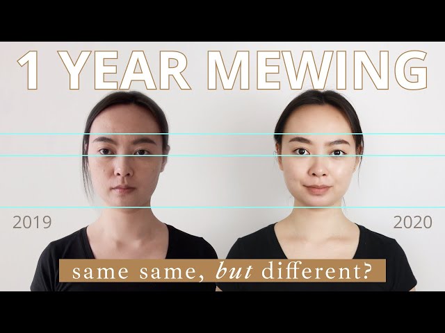 The Benefits of Mewing: What Does Mewing Really Do?