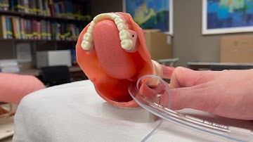 TEE Insertion Made Easy