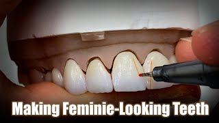 Making Feminine-Looking Teeth | Membrane & Translucency