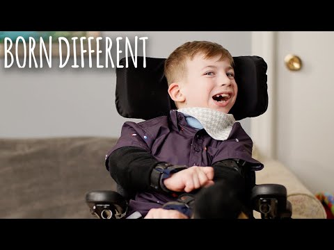The Boy Who Can&rsquo;t Stop Biting Himself | BORN DIFFERENT