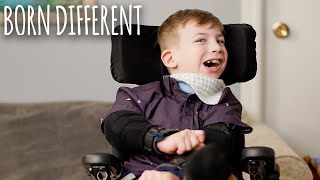 The Boy Who Can't Stop Biting Himself | BORN DIFFERENT