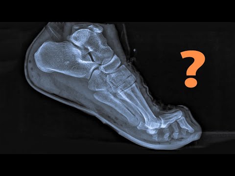 Dica de Corrida - Tênis Ficou Apertado - O que fazer? - YouTube