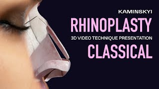 BASIC CLASSICAL PRESERVATION RHINOPLASTY by CLOSED TECHNIQUE / KAMINSKYI