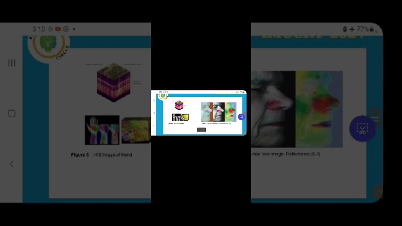 IMCCRT-2024-8144 Title - A Comprehensive Analysis on Diverse Types of Skin Cancer and Enhanced