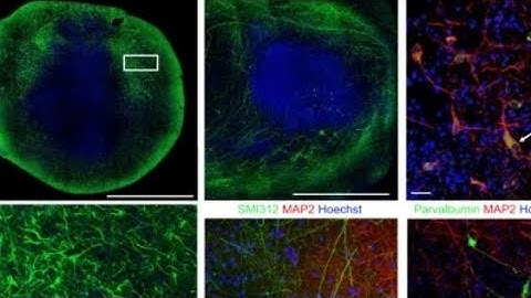 Synthetic nervous systems interface with humans, robots, and cyborgs 