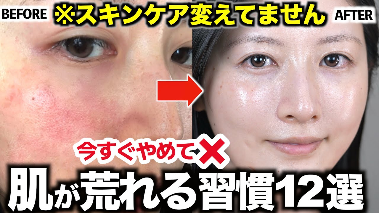 NG美容❌どんな美容液も無駄になるダメ習慣12選【毛穴/肌荒れ/ニキビ/乾燥/老化】