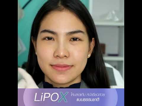 Lipo X