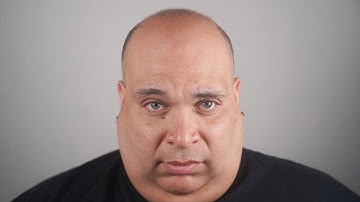 Andy: Before + After Scalp Micro Pigmentation at The Scalp Shop